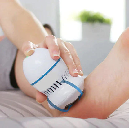 Luméa Vacuum Callus Remover